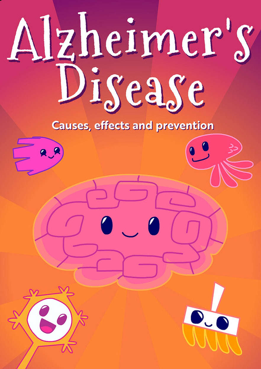 Alzheimer